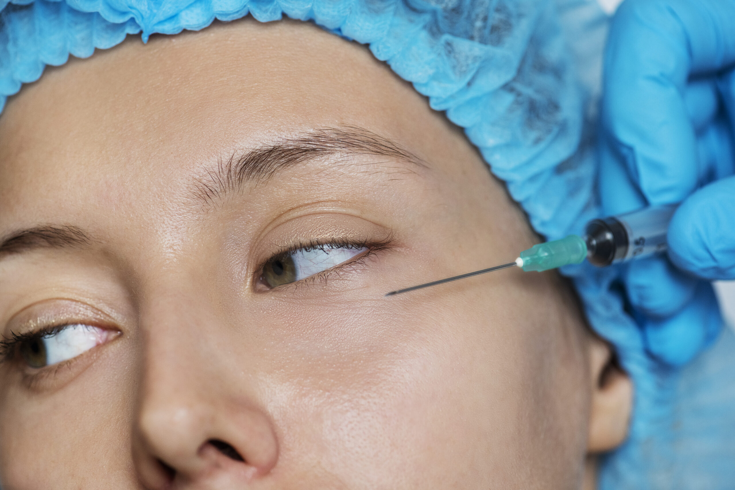 Patiente en consultation de médecine esthétique du visage à Marseille